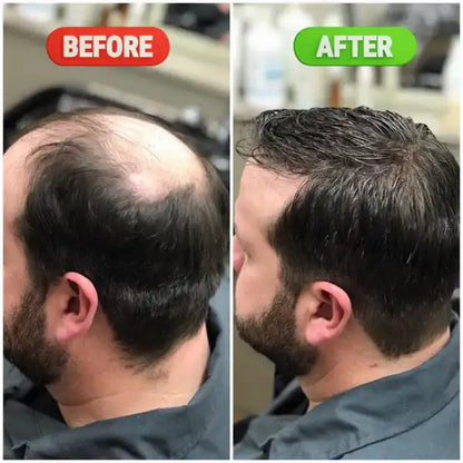 Rosemary & Rice Water Hair Growth Spray