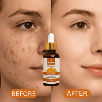 Relax Vitamin C Daily Serum