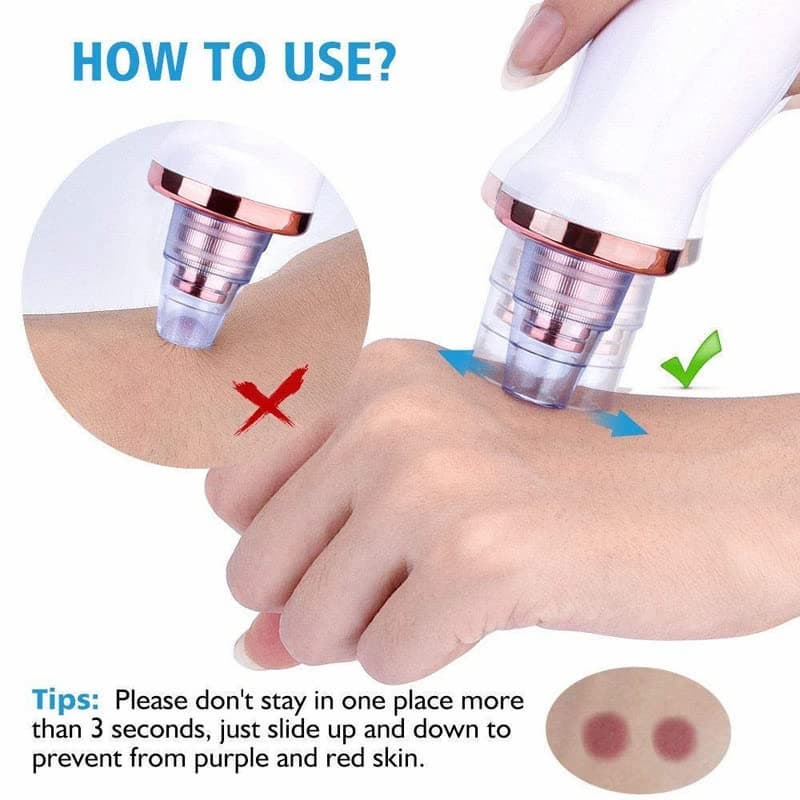 ⭐ DermaGlow™ 5-in-1 Acne & Blackhead Remover Pro