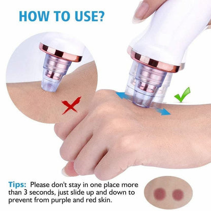 ⭐ DermaGlow™ 5-in-1 Acne & Blackhead Remover Pro