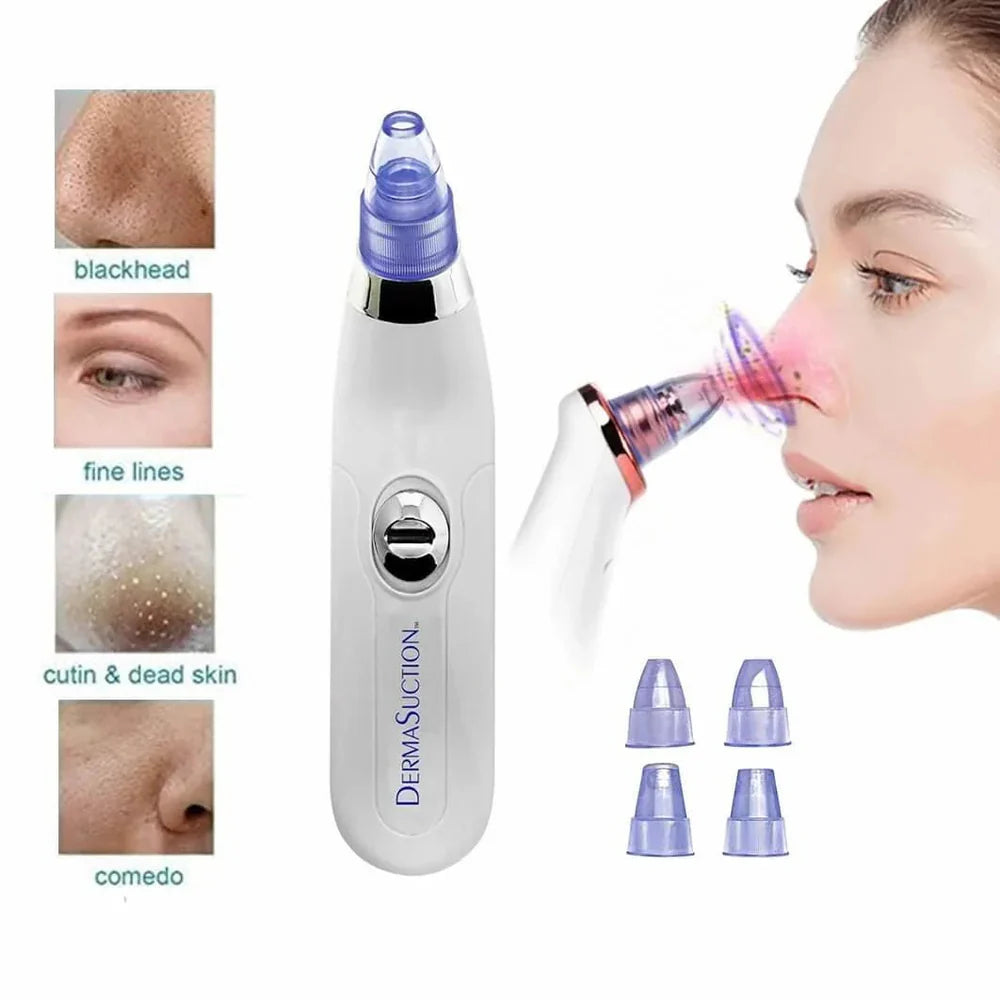 ⭐ DermaGlow™ 5-in-1 Acne & Blackhead Remover Pro