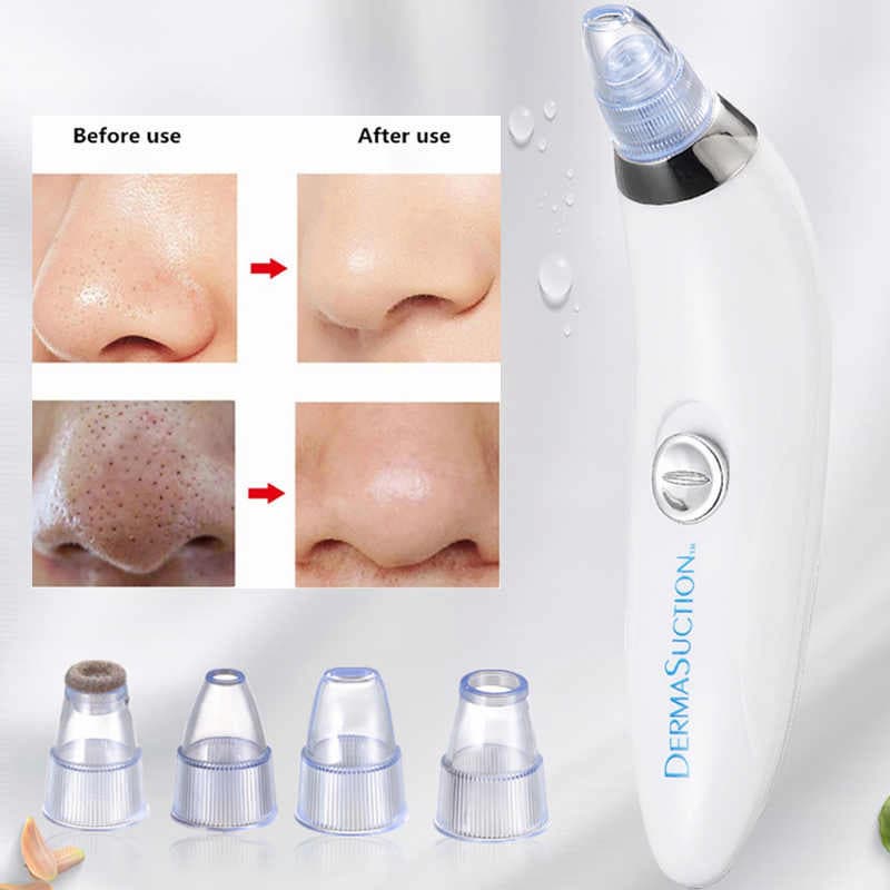 ⭐ DermaGlow™ 5-in-1 Acne & Blackhead Remover Pro