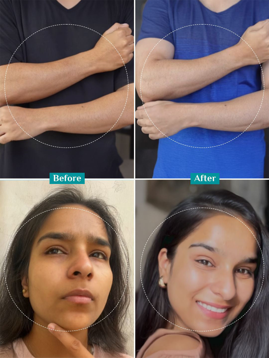 Pilgrim Peeling Solution For Tan Removal