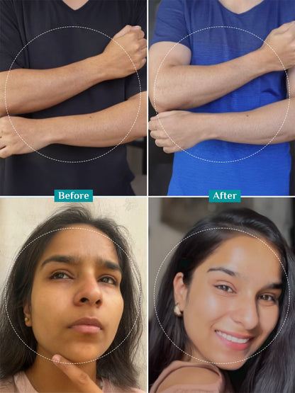 Pilgrim Peeling Solution For Tan Removal